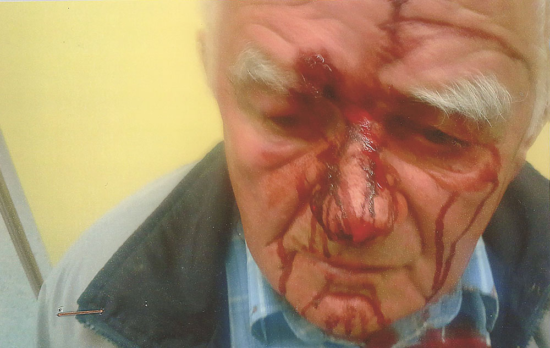 TEKLA JE KRI Klemenčičev tast 85-letniku prebil čelo