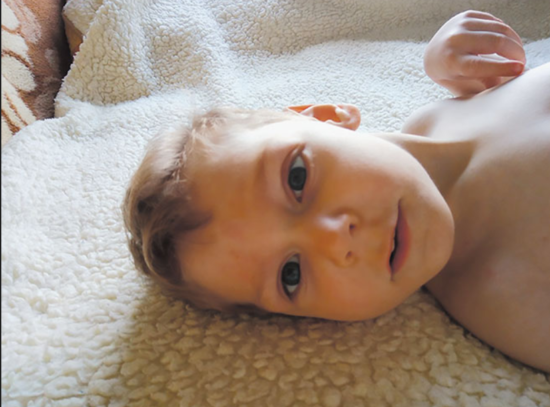 Nepričakovane spremembe po cepljenju: Triletni Mark ne vidi, ne sliši, ne govori in ne hodi