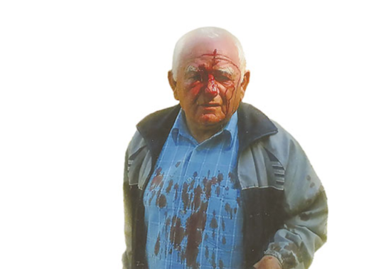 Agresiven ministrov tast: Napadel in poškodoval 82-letnika – tekla je kri!