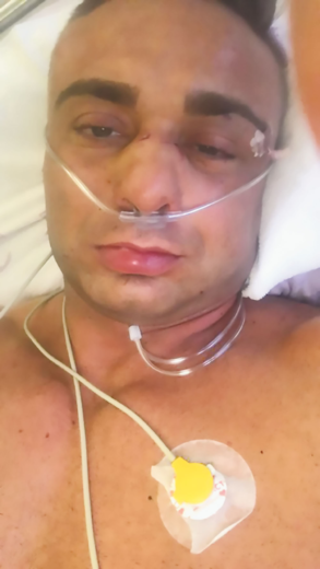 FOTO: So si ga izbrali, da bi si ustvarili renome? Romi z nožem in brcami v glavo nad Saša