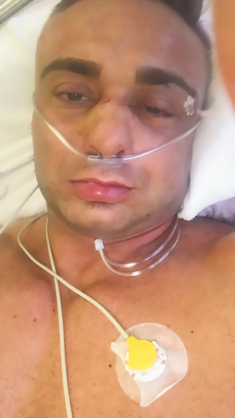 FOTO: So si ga izbrali, da bi si ustvarili renome? Romi z nožem in brcami v glavo nad Saša