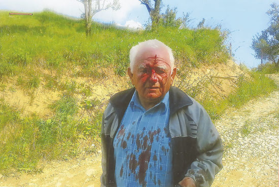 SODNA KALVARIJA Žrtev ministrove družine na sodno pravico čaka zaman