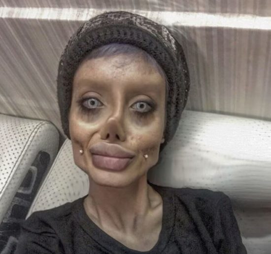 FOTO: PREVARA JE RAZKRITA! Lažna Angelina ni imela 50 lepotnih operacij, ampak …