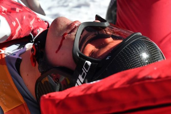 VIDEO: PRVA KRI NA OLIMPIJSKIH IGRAH Debi se je končal klavrno