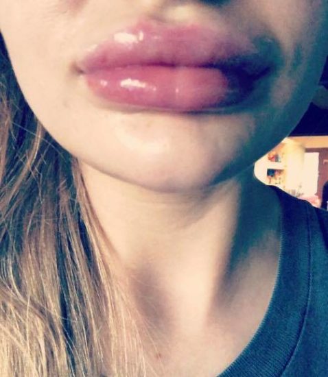 »Naša polnila so v redu. Vprašaj svojega fanta, kje je imel svoj penis.«
