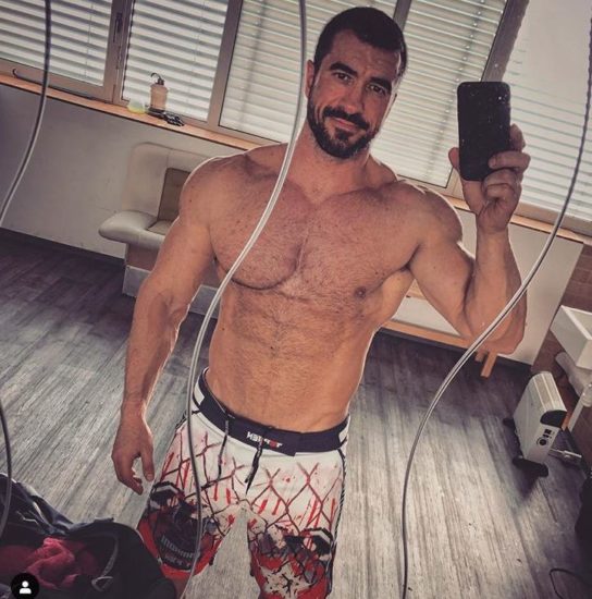 FOTO: Marko Potrč odšel pod nož in objavil fotografijo po posegu: Kožni rak je najpogostejša oblika raka