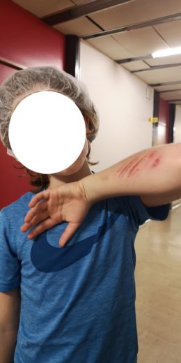 Nedeljska drama v UKC Ljubljana in še globa, oče: “otroka pripelješ na urgenco z veliko odprto rano na glavi, krvavitvami ter pretresom možganov”