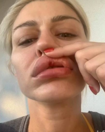 Grozljiv posnetek! Manekenka in resničnostna zvezdnica Sandra  posnela nasilnega moža