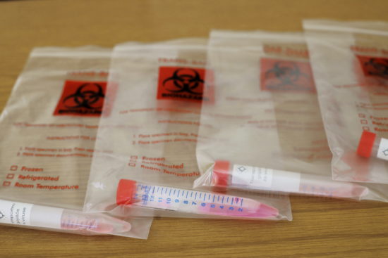 #Koronavirus: V Sloveniji nove okužbe, znano s katerih občin prihajajo