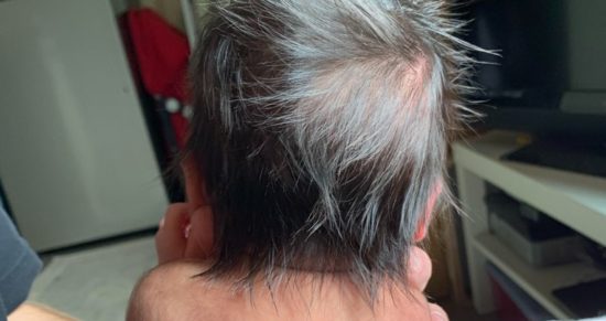 FOTO: Otrok rojen s sivimi lasmi: 2020 je tako stresno, da se tudi dojenčki rodijo sivi