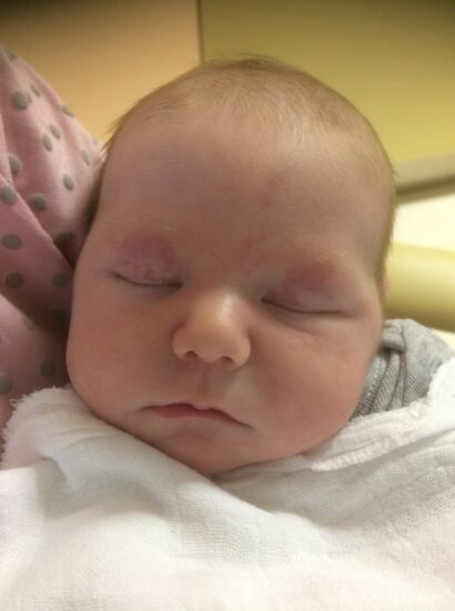 Za malega borca Naceta čimprej potrebujejo zdravilo