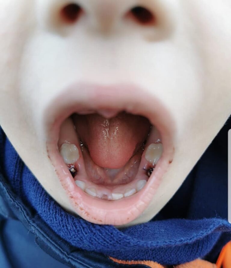 Mamica Dijana ponuja 5 tisočakov, za informacije o pogrešanih malčkih! Oče se je javil na FB: Kdo je sinu spulil 8 zob naenkrat