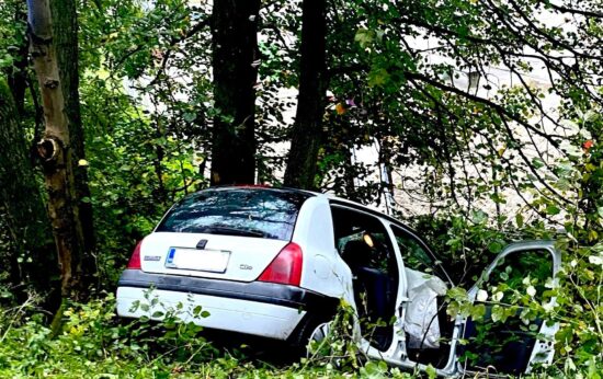FOTO: Grozne posledice nesreče, polomljene obrazne kosti